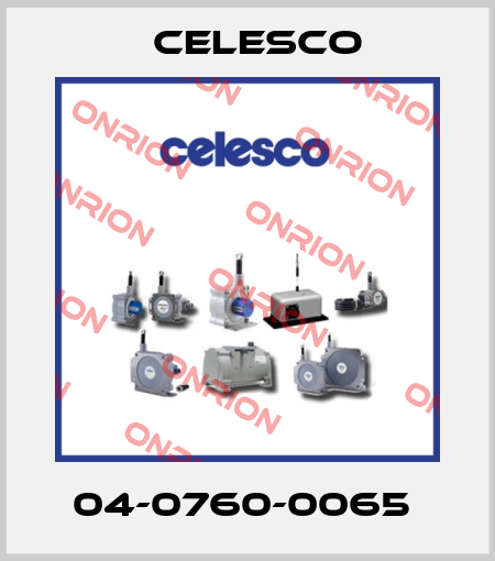 04-0760-0065  Celesco